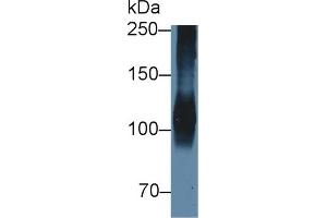 Detection of ATP1a1 in Porcine Cerebrum lysate using Polyclonal Antibody to ATPase, Na+/K+ Transporting Alpha 1 Polypeptide (ATP1a1) (ATP1A1 antibody  (AA 493-660))