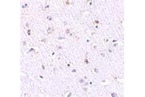 Immunohistochemical staining of human brain tissue with 2. (Nanos Homolog 1 antibody  (N-Term))