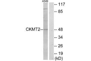 Western Blotting (WB) image for anti-Creatine Kinase, Mitochondrial 2 (Sarcomeric) (CKMT2) (Internal Region) antibody (ABIN1849200)