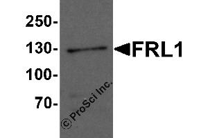 Western Blotting (WB) image for anti-Formin-Like 1 (FMNL1) (C-Term) antibody (ABIN1077402) (Formin-Like 1 antibody  (C-Term))