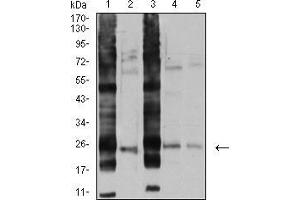 Western blot analysis using RALB mouse mAb against A549 (1), U251 (2), HT-29 (3), HEK293 (4), and LOVO (5) cell lysate.