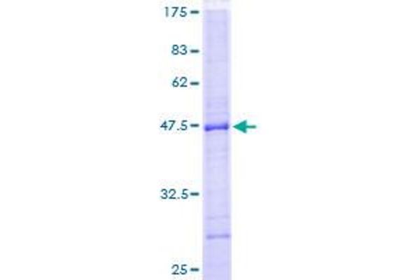 PTPN22 Protein (AA 1-179) (GST tag)