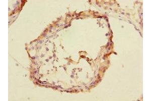 Immunohistochemistry of paraffin-embedded human testis tissue using ABIN7151282 at dilution of 1:100 (TRIM69 antibody  (AA 1-341))