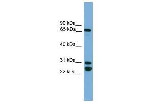 Western Blot showing DNAI2 antibody used at a concentration of 1-2 ug/ml to detect its target protein. (DNAI2 antibody  (N-Term))