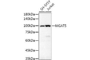 Western blot analysis of extracts of various cell lines, using MG Rabbit pAb antibody (ABIN6132962, ABIN6143817, ABIN6143818 and ABIN6214861) at 1:500 dilution. (MGAT5 antibody  (AA 627-741))