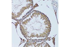 Immunohistochemistry of paraffin-embedded mouse testis using RPN1 antibody.