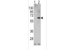 Western blot analysis of PRKAA2 using rabbit polyclonal PRKAA2 Antibody using 293 cell lysates (2 ug/lane) either nontransfected (Lane 1) or transiently transfected with the PRKAA2 gene (Lane 2). (PRKAA2 antibody  (C-Term))