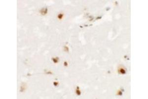 Immunohistochemistry of SHANK3 in human brain tissue with SHANK3 antibody at 2. (SHANK3 antibody  (Middle Region))