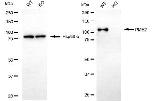 Western blotting analysis using PMS2 antibody (ABIN7799858).