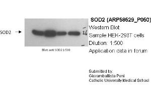 Western Blotting (WB) image for anti-Superoxide Dismutase 2, Mitochondrial (SOD2) (N-Term) antibody (ABIN2787727) (SOD2 antibody  (N-Term))