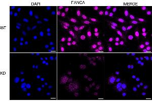 anti-Fanconi Anemia Group A Protein (FANCA) antibody
