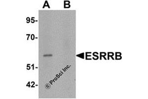 Western Blotting (WB) image for anti-Estrogen-Related Receptor beta (ESRRB) (N-Term) antibody (ABIN1031374)