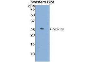 Western Blotting (WB) image for anti-Orosomucoid 2 (ORM2) (AA 19-207) antibody (ABIN1175013)