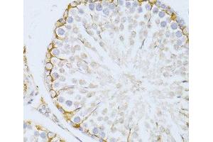Immunohistochemistry of paraffin-embedded Rat testis using PIKFYVE Polyclonal Antibody at dilution of 1:100 (40x lens). (PIKFYVE antibody)