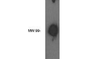 Western blot analysis using  autotaxin antibody on human brain lysate. (ENPP2 antibody)