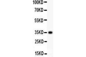 Anti- CD63 Picoband antibody, Western blotting All lanes: Anti CD63  at 0. (CD63 antibody  (AA 97-238))