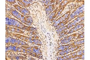 ABIN7094702 and ABIN7098753 at 1/100 staining Rat colorectal tissue by IHC-P. (SET/TAF-I antibody  (N-Term))