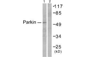 Western blot analysis of extracts from Jukat cells, using Parkin antibody (ABIN5976483).