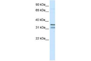 WB Suggested Anti-NKX2-2 Antibody Titration:  0. (Nkx2-2 antibody  (N-Term))