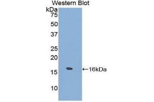 Western Blotting (WB) image for anti-Tryptase delta 1 (TPSD1) (AA 99-191) antibody (ABIN1860851) (TPSD1 antibody  (AA 99-191))