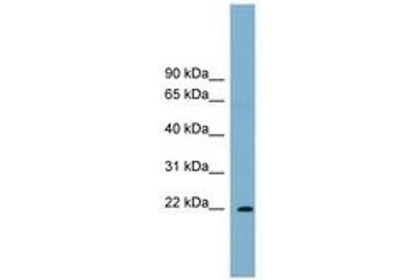 PCNP antibody  (C-Term)