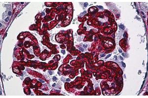 Human Kidney, Glomeruli: Formalin-Fixed, Paraffin-Embedded (FFPE) (CD34 antibody)