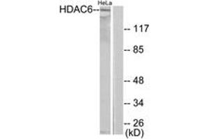 Western blot analysis of extracts from HeLa cells, using HDAC6 Antibody. (HDAC6 antibody  (AA 1166-1215))