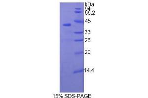 SDS-PAGE (SDS) image for Slow Skeletal Troponin T (TNNT1) (AA 1-259) protein (His tag) (ABIN1081048)