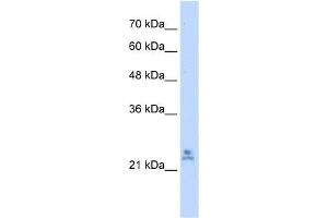 WB Suggested Anti-MRPS15 Antibody Titration:  2. (MRPS15 antibody  (C-Term))