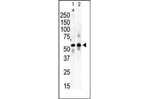 Western Blotting (WB) image for anti-Phosphatidylinositol 4-Kinase Type 2 beta (PI4K2B) (C-Term) antibody (ABIN360474) (PI4K2B antibody  (C-Term))