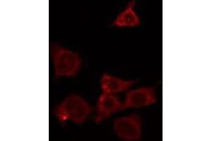 ABIN6266628 staining HeLa by IF/ICC. (RASH/RASK/RASN antibody)