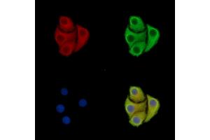 anti-ADAMTS-Like 2 (ADAMTSL2) antibody