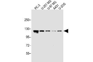 All lanes : Anti- Antibody (N-term) at 1:1000 dilution Lane 1: PC-3 whole cell lysate Lane 2: U-251 MG whole cell lysate Lane 3: U-87 MG whole cell lysate Lane 4: A431 whole cell lysate Lane 5: U-2OS whole cell lysate Lysates/proteins at 20 μg per lane. (SEL1L3 antibody  (N-Term))