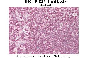 Image no. 1 for anti-E2F Transcription Factor 1 (E2F1) (Internal Region), (Lys120) antibody (ABIN571306) (E2F1 antibody  (Internal Region, Lys120))