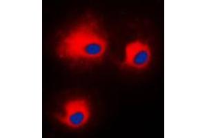 Immunofluorescent analysis of PKC theta (pS676) staining in HeLa cells. (PKC theta antibody  (C-Term, pSer676))