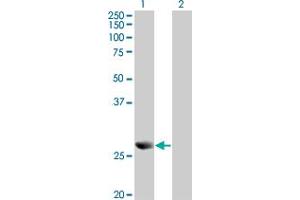Western Blot analysis of PRDX4 expression in transfected 293T cell line by PRDX4 monoclonal antibody (M01A), clone 2C12. (Peroxiredoxin 4 antibody  (AA 51-150))