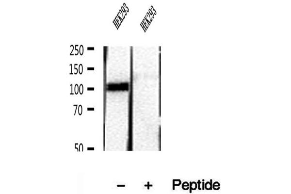 RBM15 anticorps  (N-Term)