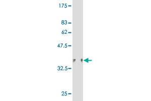 Western Blot detection against Immunogen (36. (HIPK1 antibody  (AA 330-430))