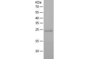 Western Blotting (WB) image for DiGeorge Syndrome Critical Region Gene 6-Like (DGCR6L) (AA 1-220) protein (His tag) (ABIN7288666) (DGCR6L Protein (AA 1-220) (His tag))