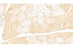 Detection of GTF2H1 in Human Skeletal muscle Tissue using Polyclonal Antibody to General Transcription Factor IIH Subunit 1 (GTF2H1) (GTF2H1 antibody  (AA 84-335))