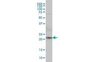 NKIRAS2 monoclonal antibody (M02), clone 2G9 Western Blot analysis of NKIRAS2 expression in HeLa . (NKIRAS2 antibody  (AA 1-191))