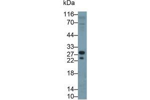 Detection of TK1 in Porcine Lymph node lysate using Polyclonal Antibody to Thymidine Kinase 1, Soluble (TK1) (TK1 antibody  (AA 2-234))