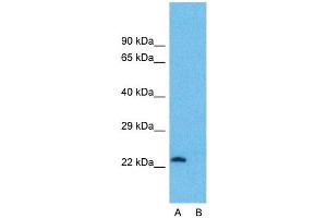 Host:  Rabbit  Target Name:  ATF3  Sample Type:  OVCAR-3  Lane A:  Primary Antibody  Lane B:  Primary Antibody + Blocking Peptide  Primary Antibody Concentration:  1ug/ml  Peptide Concentration:  5ug/ml  Lysate Quantity:  25ug/lane/lane  Gel Concentration:  0. (ATF3 antibody  (Middle Region))