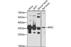 Western blot analysis of extracts of various cell lines, using RPF2 antibody (ABIN7270047) at 1:1000 dilution.