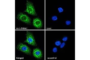 Immunofluorescence (IF) image for anti-Prolyl 4-Hydroxylase, alpha Polypeptide I (P4HA1) (Internal Region) antibody (ABIN190847)