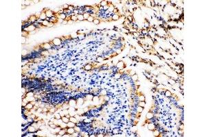 IHC-P: Vinculin antibody testing of rat intestine tissue (Vinculin antibody  (AA 173-188))