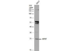 WB Image HPRT antibody detects HPRT protein by western blot analysis.