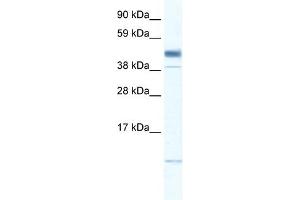 WB Suggested Anti-ZMAT1 Antibody Titration: 0. (ZMAT1 antibody  (Middle Region))