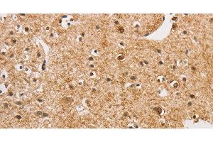 Immunohistochemistry of paraffin-embedded Human brain using ARHGEF5 Polyclonal Antibody at dilution of 1:50 (ARHGEF5 antibody)