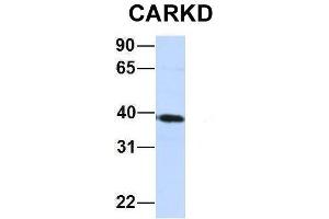 Host:  Rabbit  Target Name:  CARKD  Sample Type:  Jurkat  Antibody Dilution:  1. (Carkd antibody  (Middle Region))